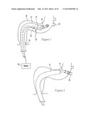 DEVICES AND METHODS FOR SECURING TISSUE diagram and image