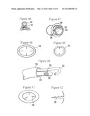 DEVICES AND METHODS FOR SECURING TISSUE diagram and image