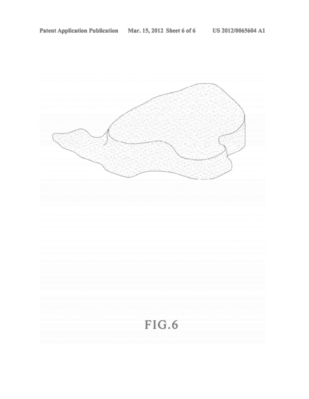 DEGRADABLE HEMOSTATIC SPONGE AND  EXTRUSION SYSTEM AND METHOD FOR     MANUFACTURING THE SAME - diagram, schematic, and image 07