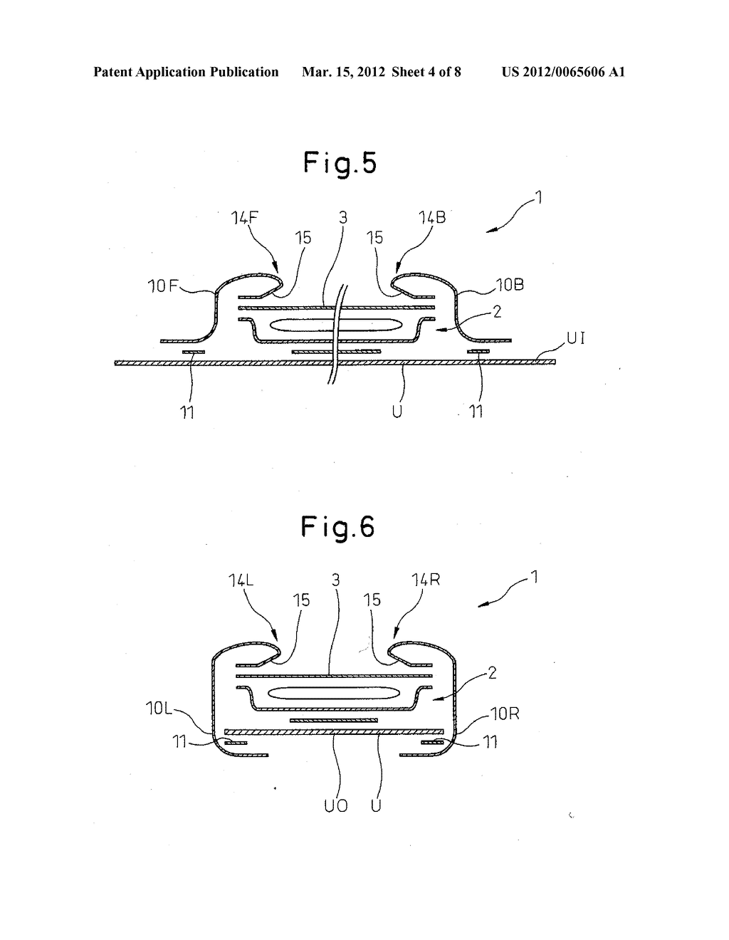 ABSORBENT ARTICLE - diagram, schematic, and image 05