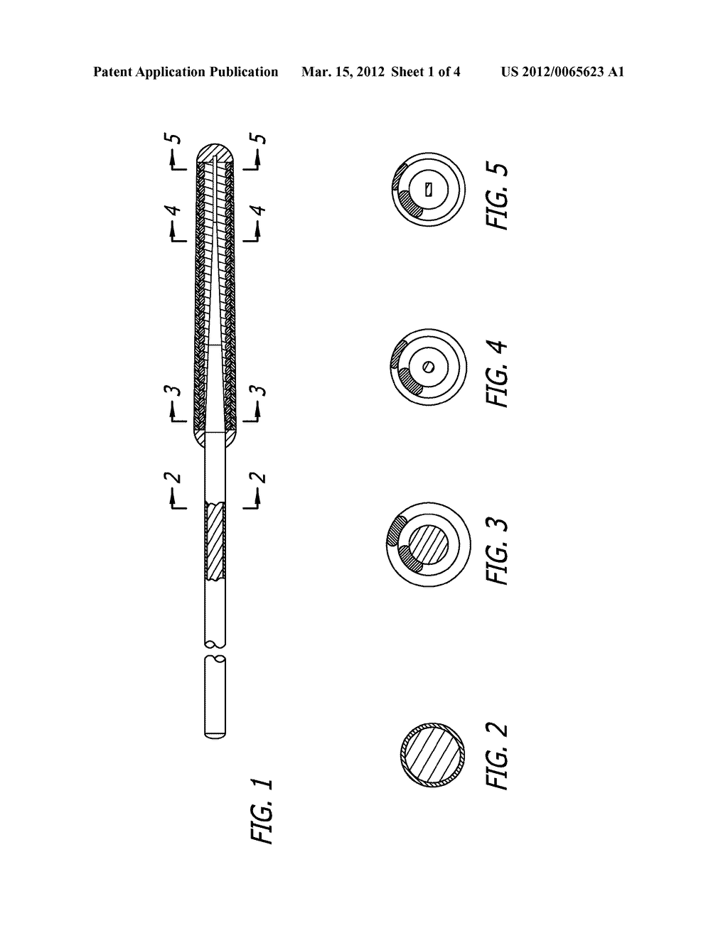 GUIDE WIRE WITH SOLDERED MULTILAYER COIL MEMBER - diagram, schematic, and image 02