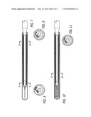 GUIDE WIRE WITH SOLDERED MULTILAYER COIL MEMBER diagram and image