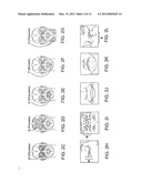 SUBDERMAL CRYOGENIC REMODELING OF MUSCLES, NERVES, CONNECTIVE TISSUE,     AND/OR ADIPOSE TISSUE (FAT) diagram and image