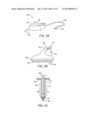 SUBDERMAL CRYOGENIC REMODELING OF MUSCLES, NERVES, CONNECTIVE TISSUE,     AND/OR ADIPOSE TISSUE (FAT) diagram and image