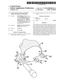 PATIENT-SPECIFIC KNEE ALIGNMENT GUIDE AND ASSOCIATED METHOD diagram and image