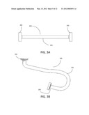 GASTRO-INTESTINLAL COMPRESSION DEVICE diagram and image