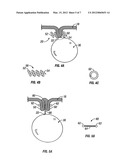 INTRA-GASTRIC FASTENING DEVICES diagram and image