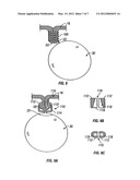 INTRA-GASTRIC FASTENING DEVICES diagram and image