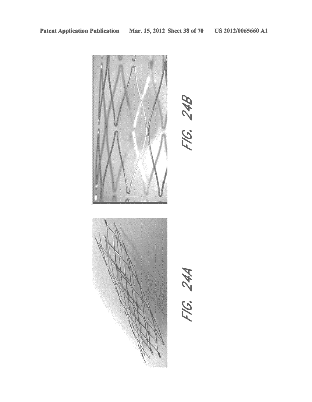 EXPANDABLE TIP ASSEMBLY FOR THROMBUS MANAGEMENT - diagram, schematic, and image 39