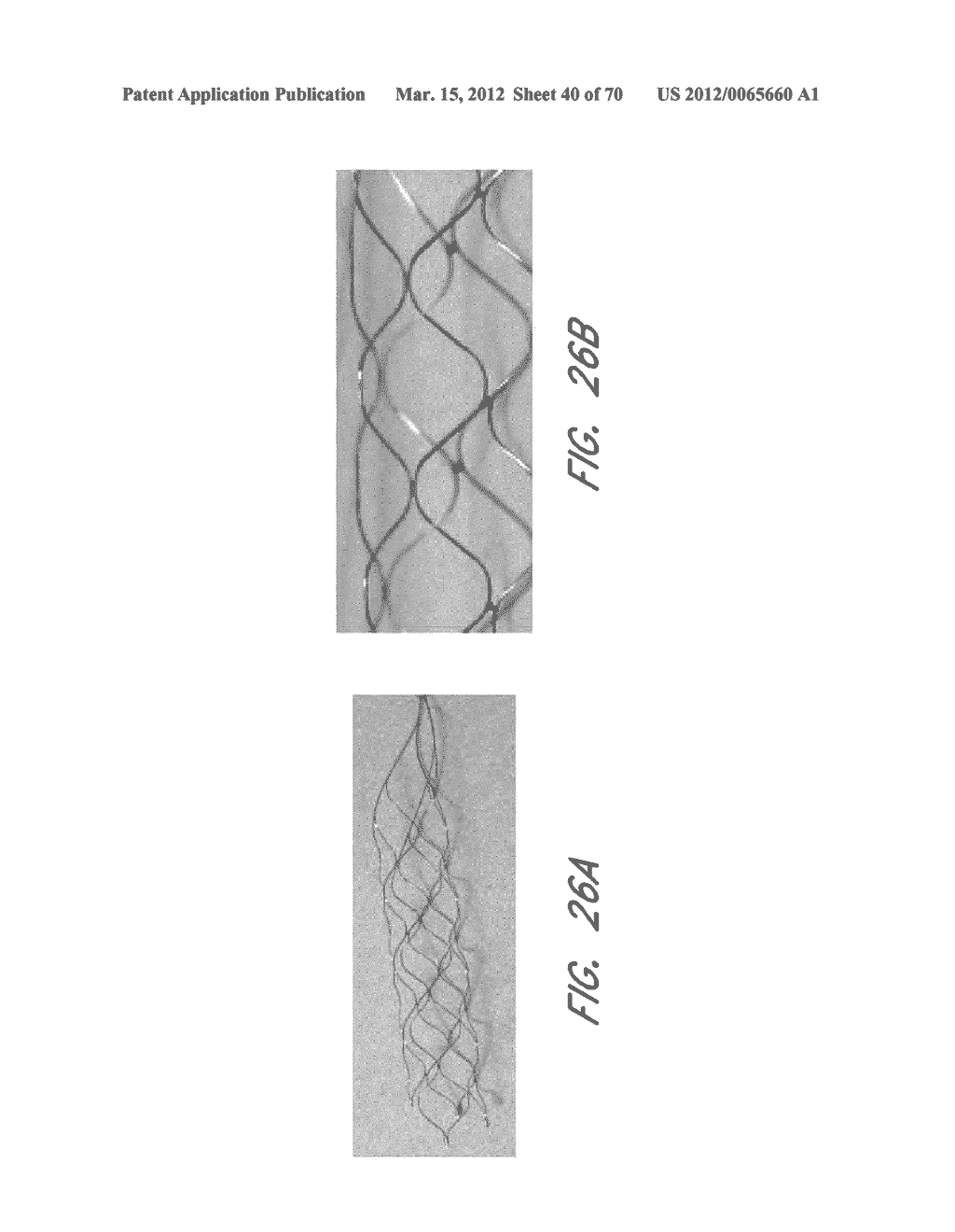 EXPANDABLE TIP ASSEMBLY FOR THROMBUS MANAGEMENT - diagram, schematic, and image 41