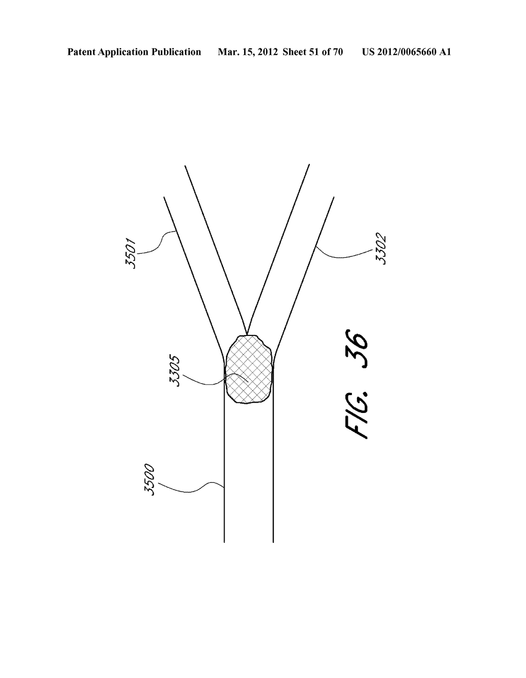 EXPANDABLE TIP ASSEMBLY FOR THROMBUS MANAGEMENT - diagram, schematic, and image 52