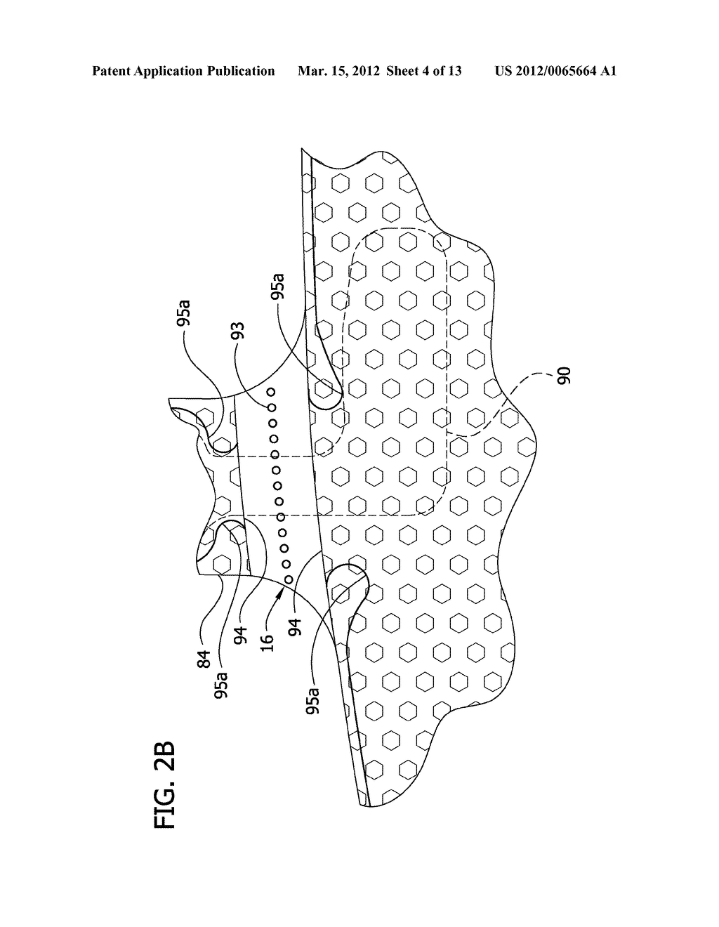 COMPRESSION SLEEVE WITH IMPROVED POSITION RETENTION - diagram, schematic, and image 05