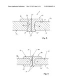 DEVICE FOR SEALING AN INCISION diagram and image