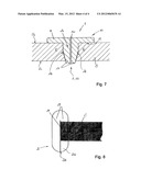 DEVICE FOR SEALING AN INCISION diagram and image