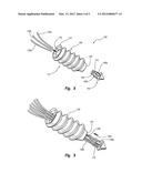 BONE ANCHORS FOR USE IN ATTACHING SOFT TISSUE TO BONE diagram and image