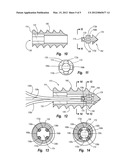 BONE ANCHORS FOR USE IN ATTACHING SOFT TISSUE TO BONE diagram and image