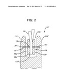 WIRED SUTURES diagram and image