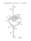 INTERSPINOUS PROCESS DISTRACTION DEVICE diagram and image