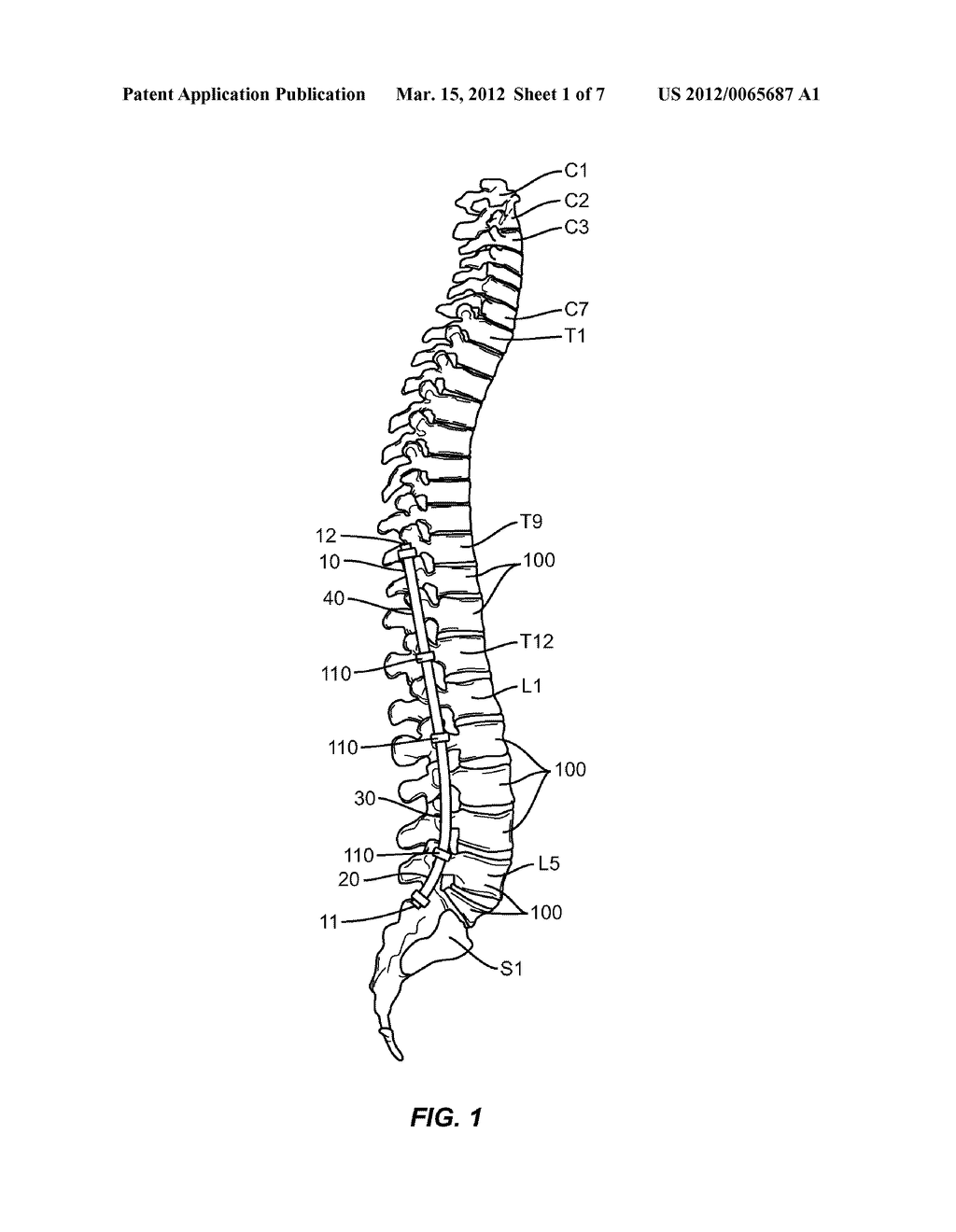 Multi-Radius Vertebral Rod With a Varying Stiffness - diagram, schematic, and image 02