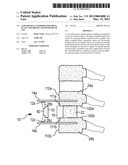 LOW-PROFILE ANTERIOR VERTEBRAL PLATE ASSEMBLIES AND METHODS OF USE diagram and image