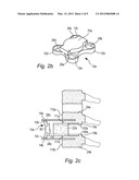 LOW-PROFILE ANTERIOR VERTEBRAL PLATE ASSEMBLIES AND METHODS OF USE diagram and image