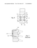 LOW-PROFILE ANTERIOR VERTEBRAL PLATE ASSEMBLIES AND METHODS OF USE diagram and image