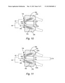 LOW-PROFILE ANTERIOR VERTEBRAL PLATE ASSEMBLIES AND METHODS OF USE diagram and image