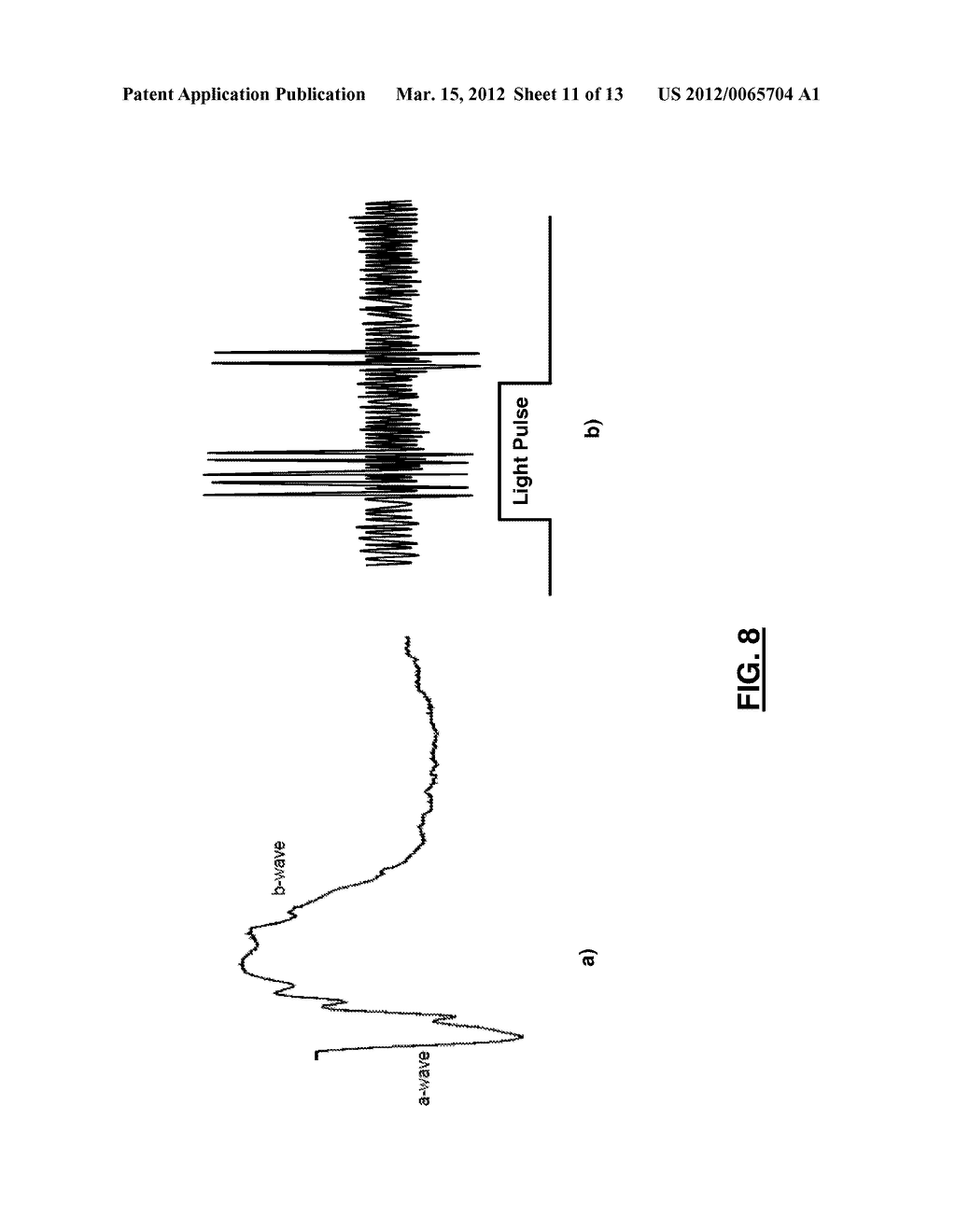 ARTIFICIAL RETINA DEVICE - diagram, schematic, and image 12