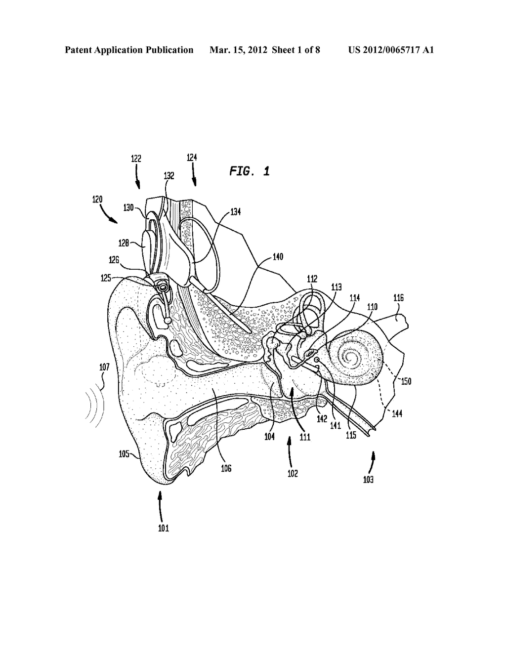 ELECTRODE ASSEMBLY FOR A STIMULATING MEDICAL DEVICE - diagram, schematic, and image 02