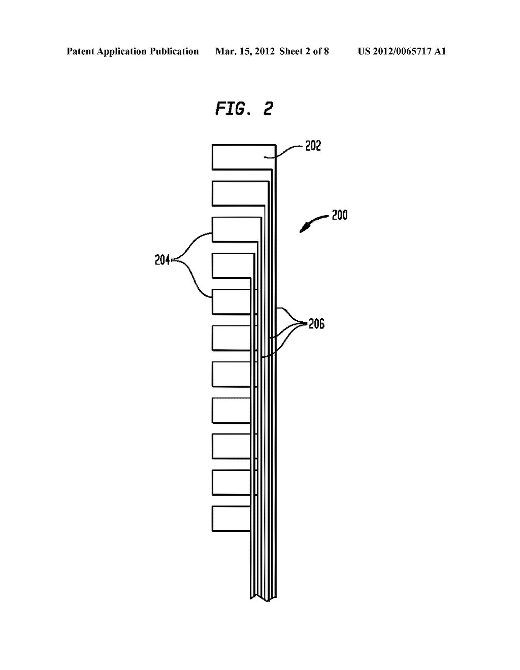 ELECTRODE ASSEMBLY FOR A STIMULATING MEDICAL DEVICE - diagram, schematic, and image 03