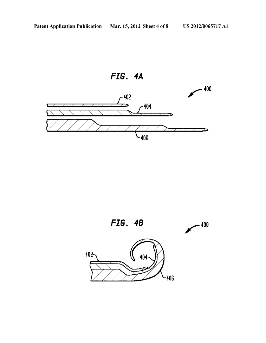 ELECTRODE ASSEMBLY FOR A STIMULATING MEDICAL DEVICE - diagram, schematic, and image 05