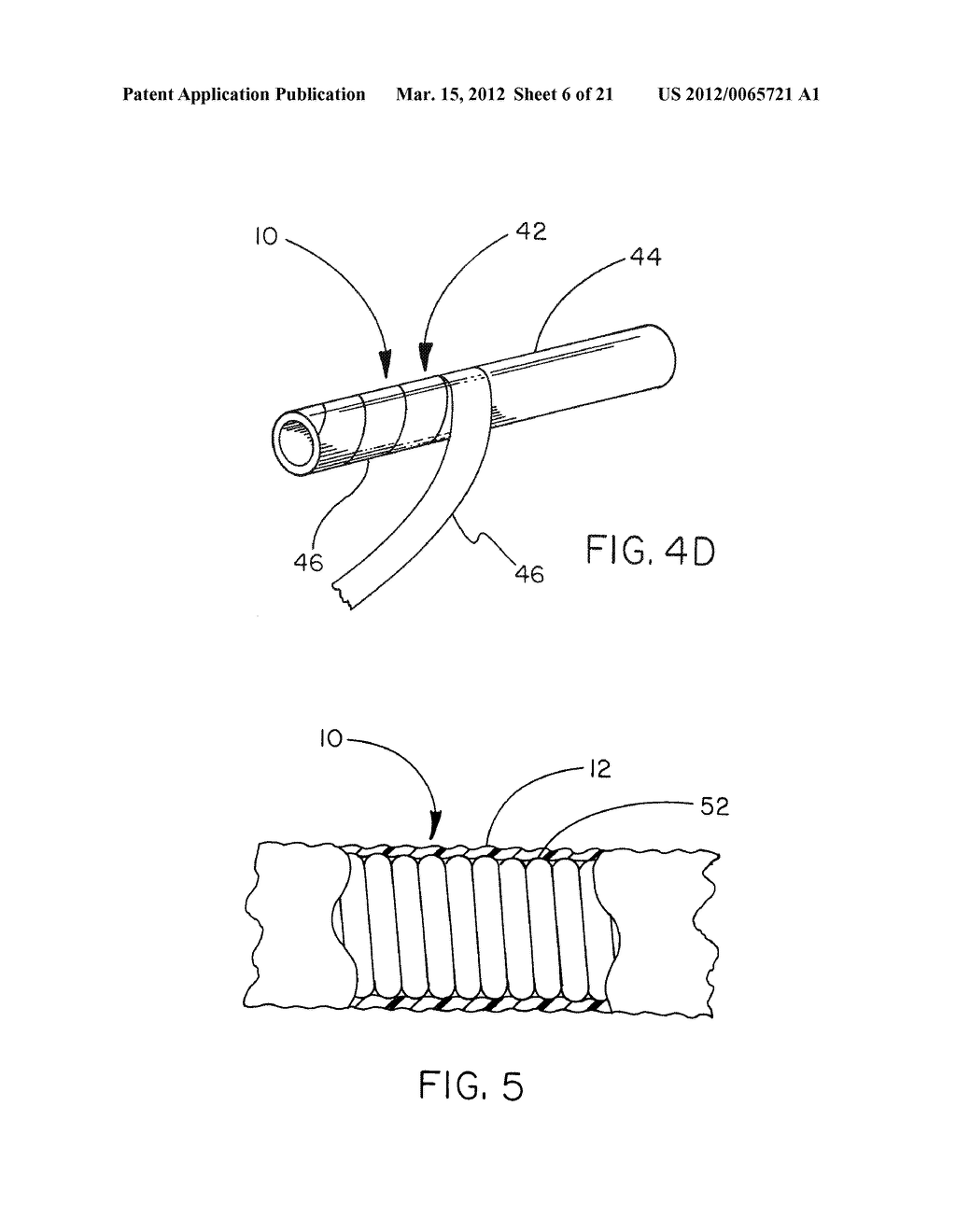 THERMOPLASTIC FLUOROPOLYMER-COATED MEDICAL DEVICES - diagram, schematic, and image 07