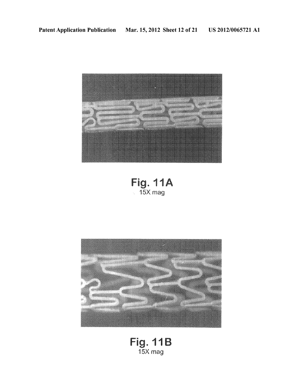 THERMOPLASTIC FLUOROPOLYMER-COATED MEDICAL DEVICES - diagram, schematic, and image 13