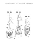 SYSTEMS AND METHODS FOR RAPIDLY DEPLOYING SURGICAL HEART VALVES diagram and image