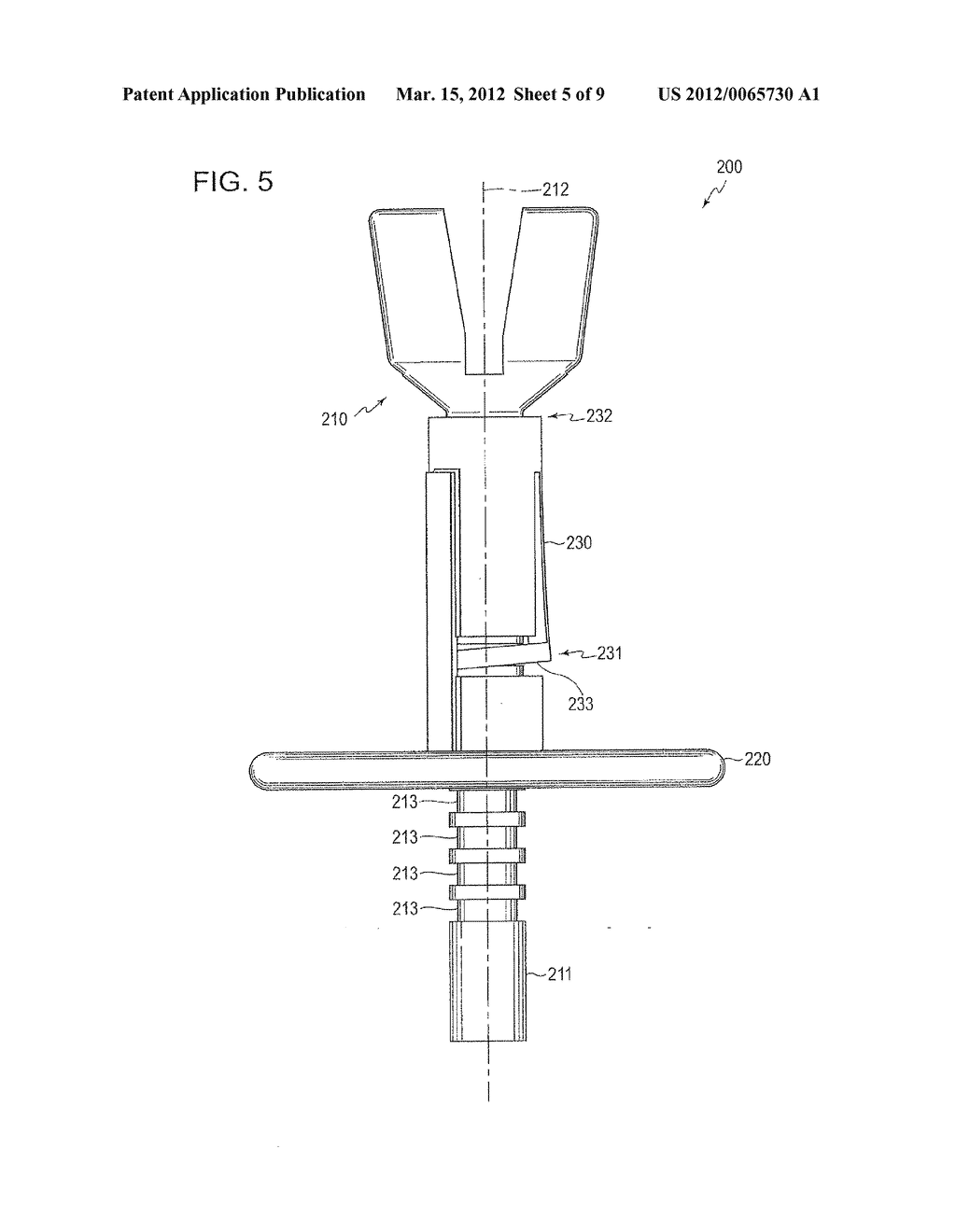 IN SITU ADJUSTABLE OSSICULAR IMPLANT AND INSTRUMENT FOR IMPLANTING AND     ADJUSTING AN ADJUSTABLE OSSICULAR IMPLANT - diagram, schematic, and image 06
