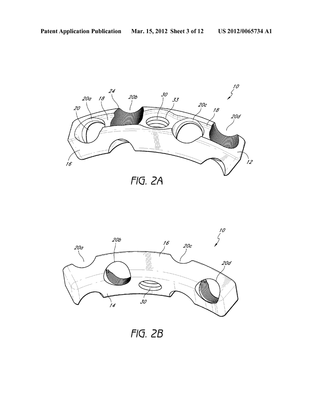 INTERVERTEBRAL PLATE SYSTEM - diagram, schematic, and image 04