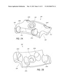 INTERVERTEBRAL PLATE SYSTEM diagram and image