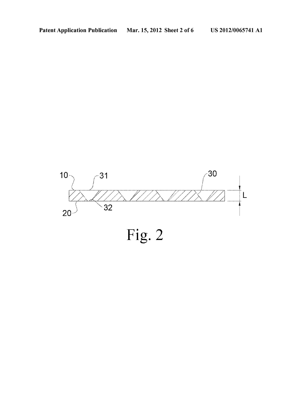 GUIDED TISSUE REGENERATION MEMBRANE - diagram, schematic, and image 03