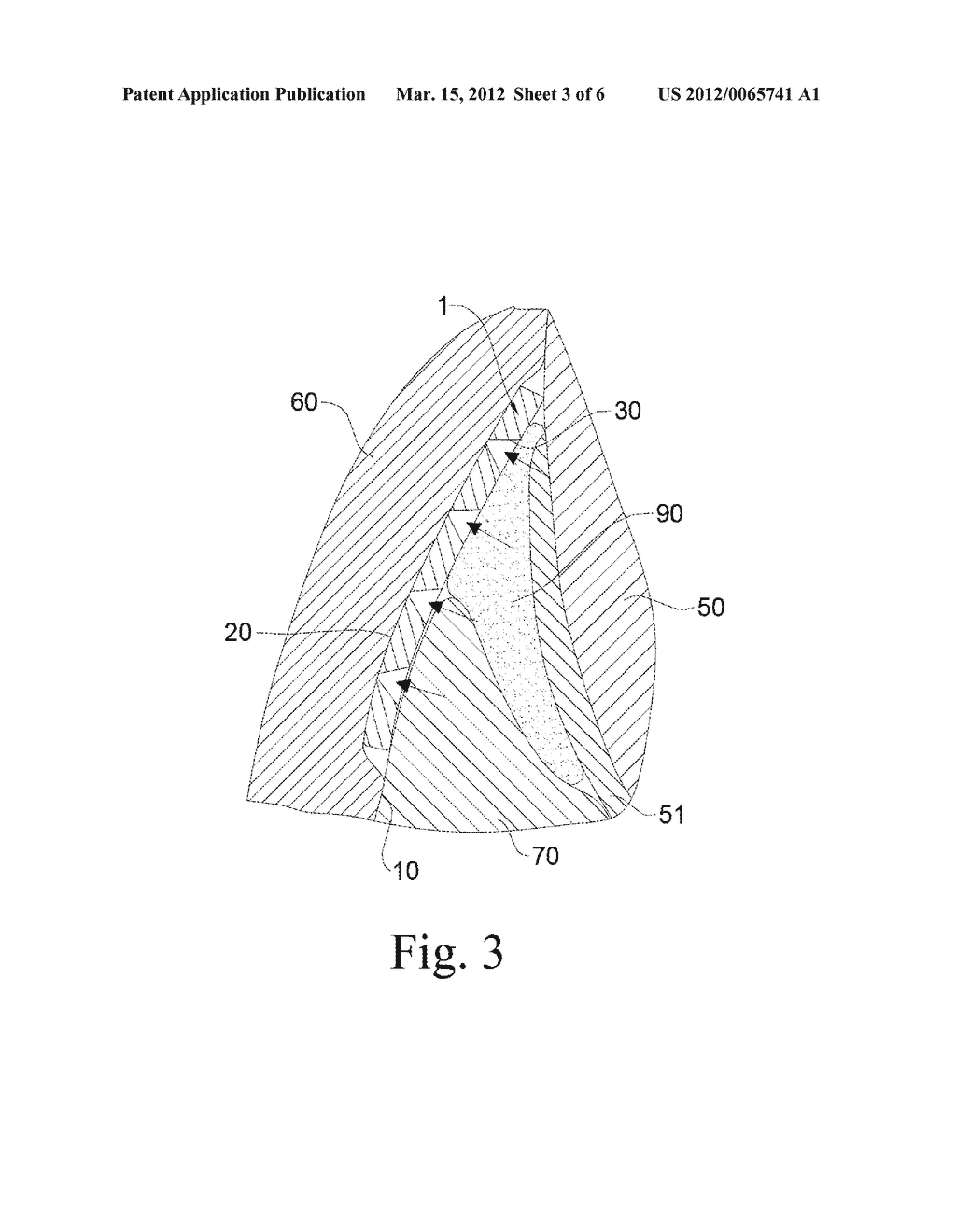 GUIDED TISSUE REGENERATION MEMBRANE - diagram, schematic, and image 04