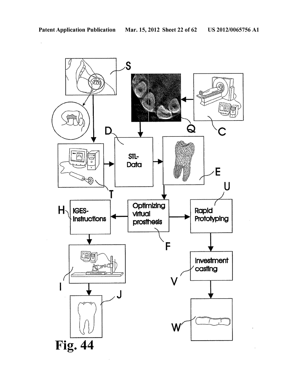 Methods of Designing and Manufacturing Customized Dental Prosthesis for     Periodontal or Osseointegration and Related Systems - diagram, schematic, and image 23