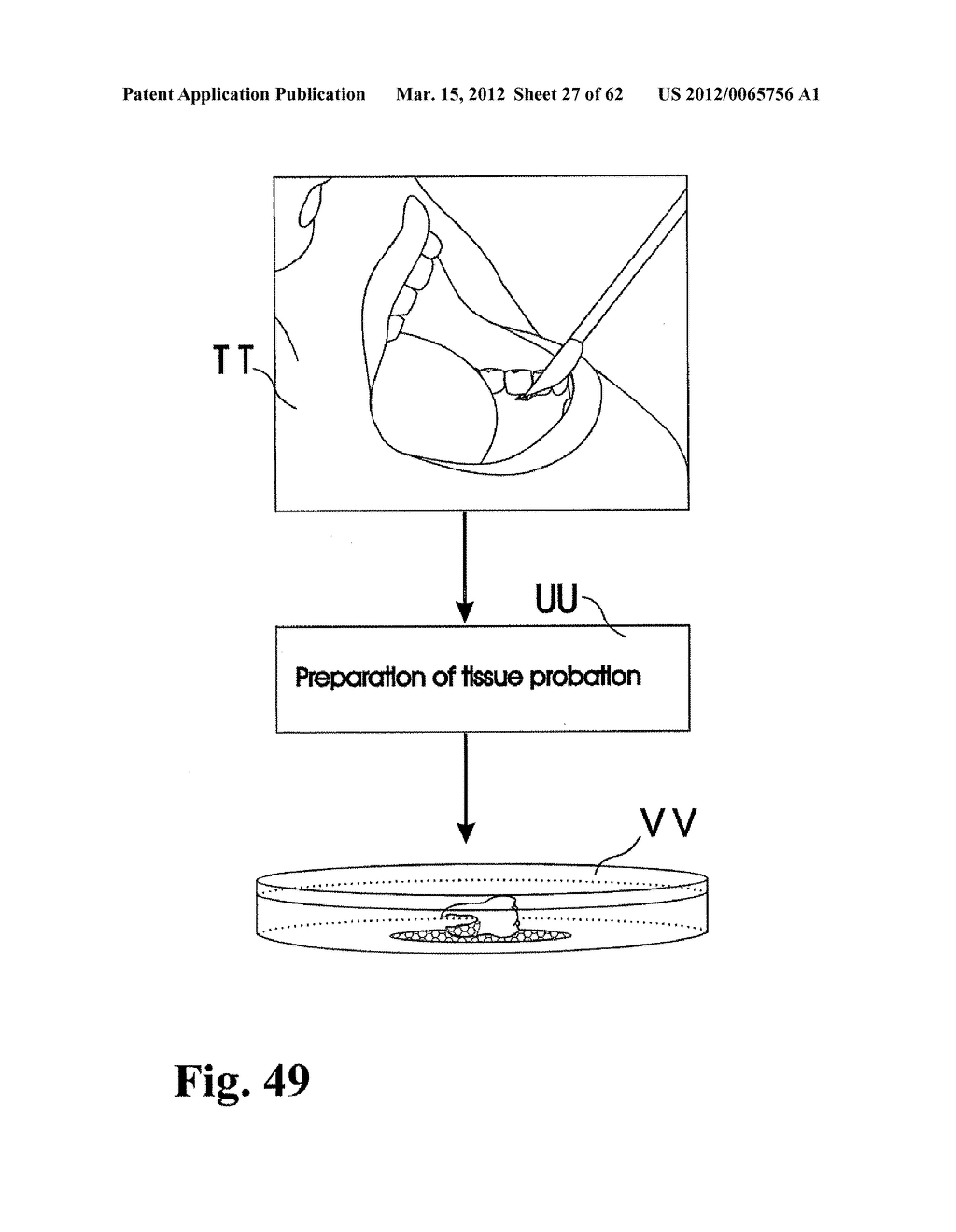 Methods of Designing and Manufacturing Customized Dental Prosthesis for     Periodontal or Osseointegration and Related Systems - diagram, schematic, and image 28