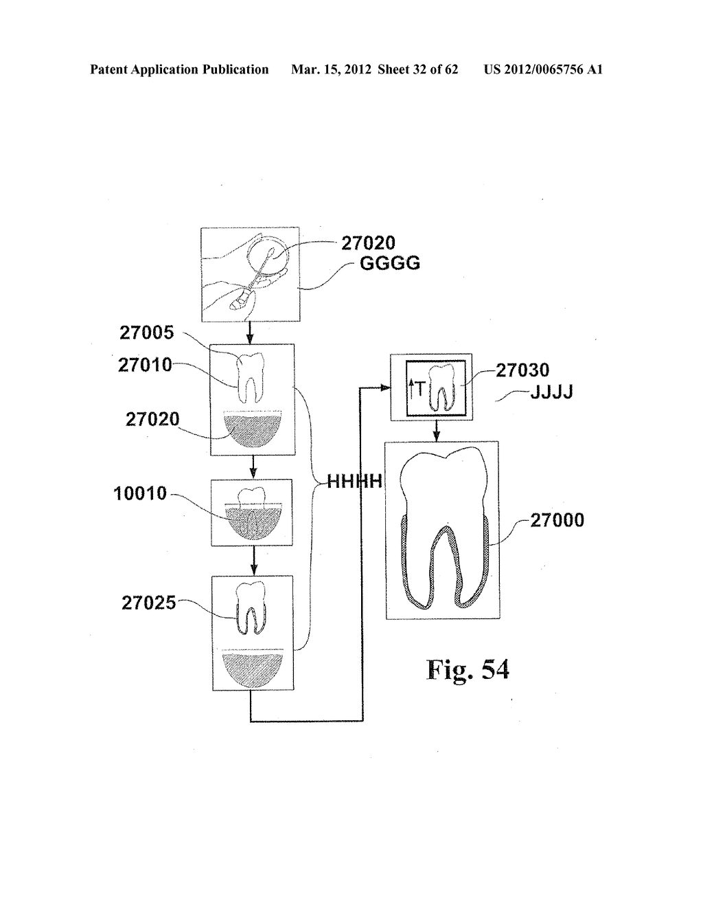 Methods of Designing and Manufacturing Customized Dental Prosthesis for     Periodontal or Osseointegration and Related Systems - diagram, schematic, and image 33