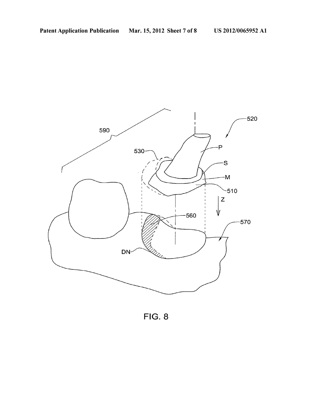 METHOD FOR MANIPULATING A DENTAL VIRTUAL MODEL, METHOD FOR CREATING     PHYSICAL ENTITIES BASED ON A DENTAL VIRTUAL MODEL THUS MANIPULATED, AND     DENTAL MODELS THUS CREATED - diagram, schematic, and image 08