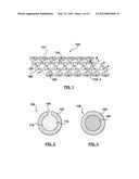 Method of Forming a Drug-Eluting Medical Device diagram and image