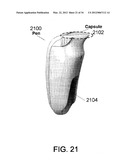 Systems and Methods for a Sample Fluid Collection Device diagram and image