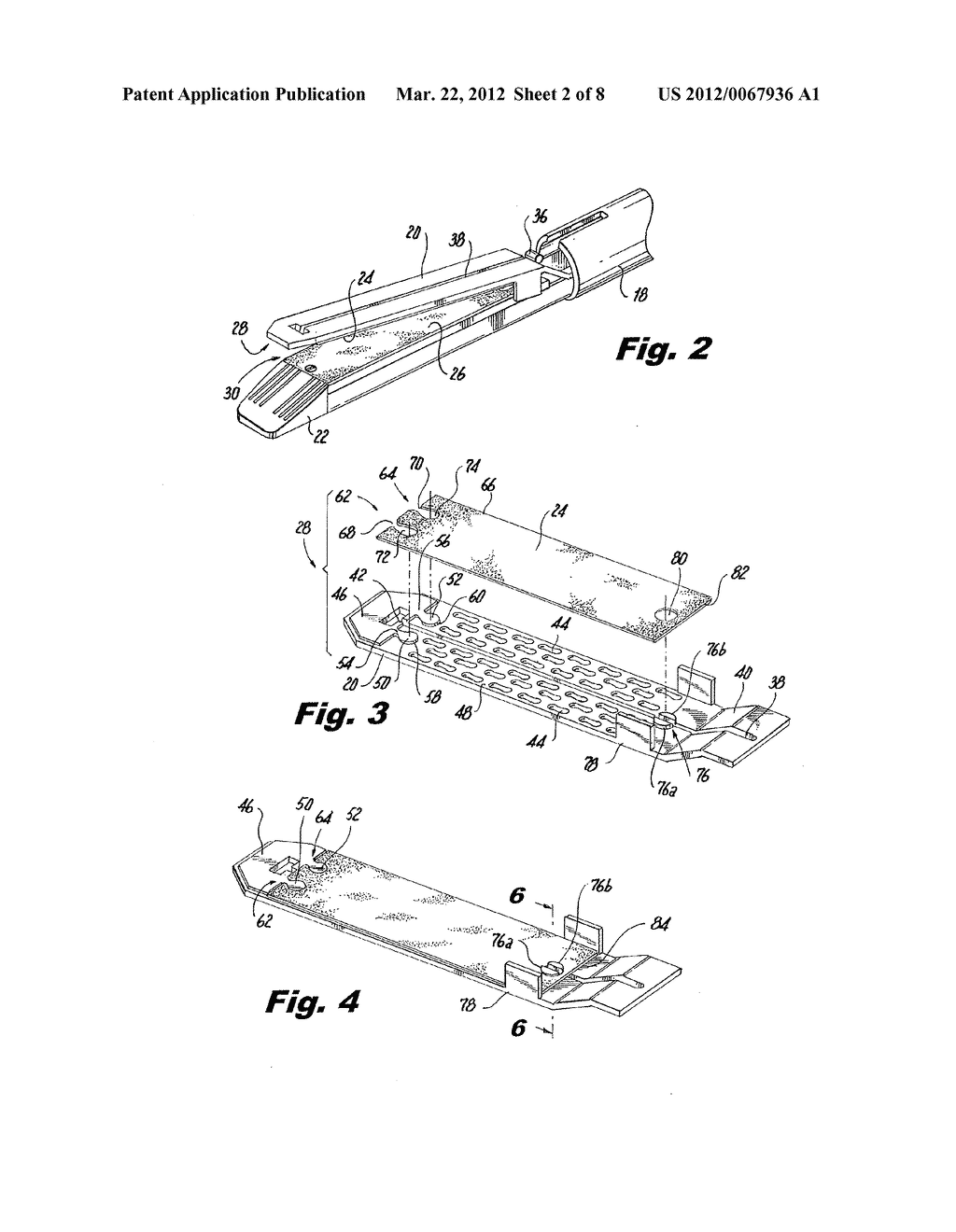 Interlocking Buttress Material Retention System - diagram, schematic, and image 03