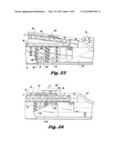 Interlocking Buttress Material Retention System diagram and image