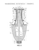 INTERNAL GASTRIC BANDER FOR OBESITY diagram and image