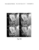 COIL ARRANGEMENT diagram and image