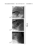 Method and System for Efficient Extraction of a Silhouette of a 3D Mesh diagram and image